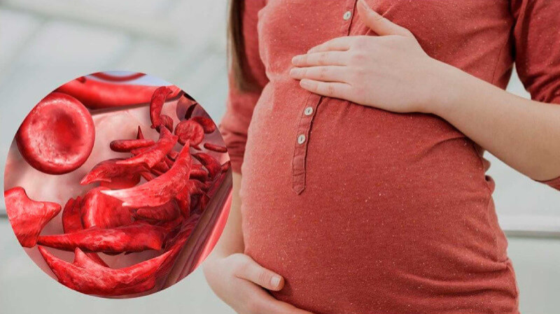 Causes of Anemia in Pregnant Women