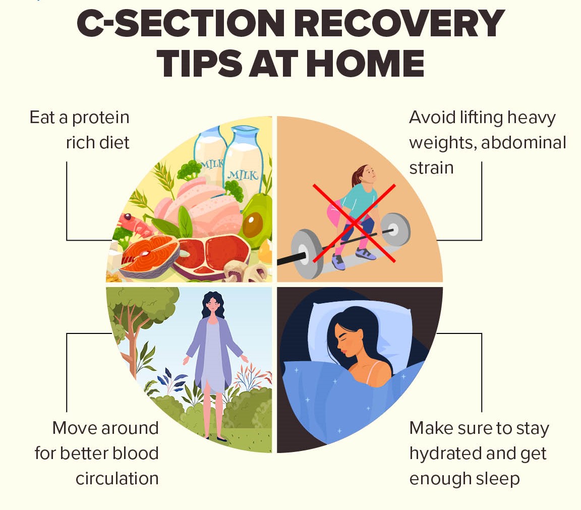 Recovering Tips for C-Section